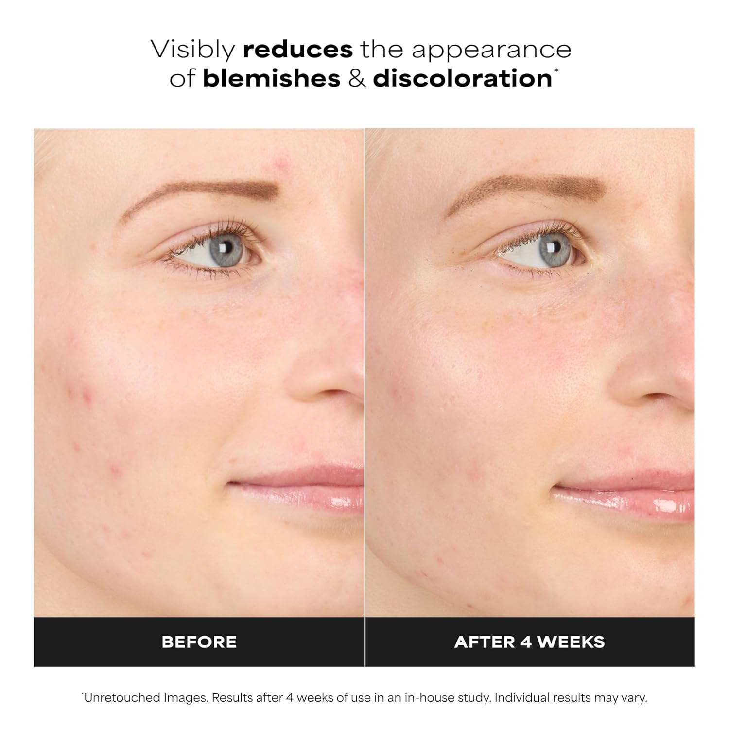 Paula's Choice BOOST 10% Azelaic Acid Booster Cream Gel Face Serum with Salicylic Acid, Oil-Free Skin Brightening Serum for Face, Fragrance-Free