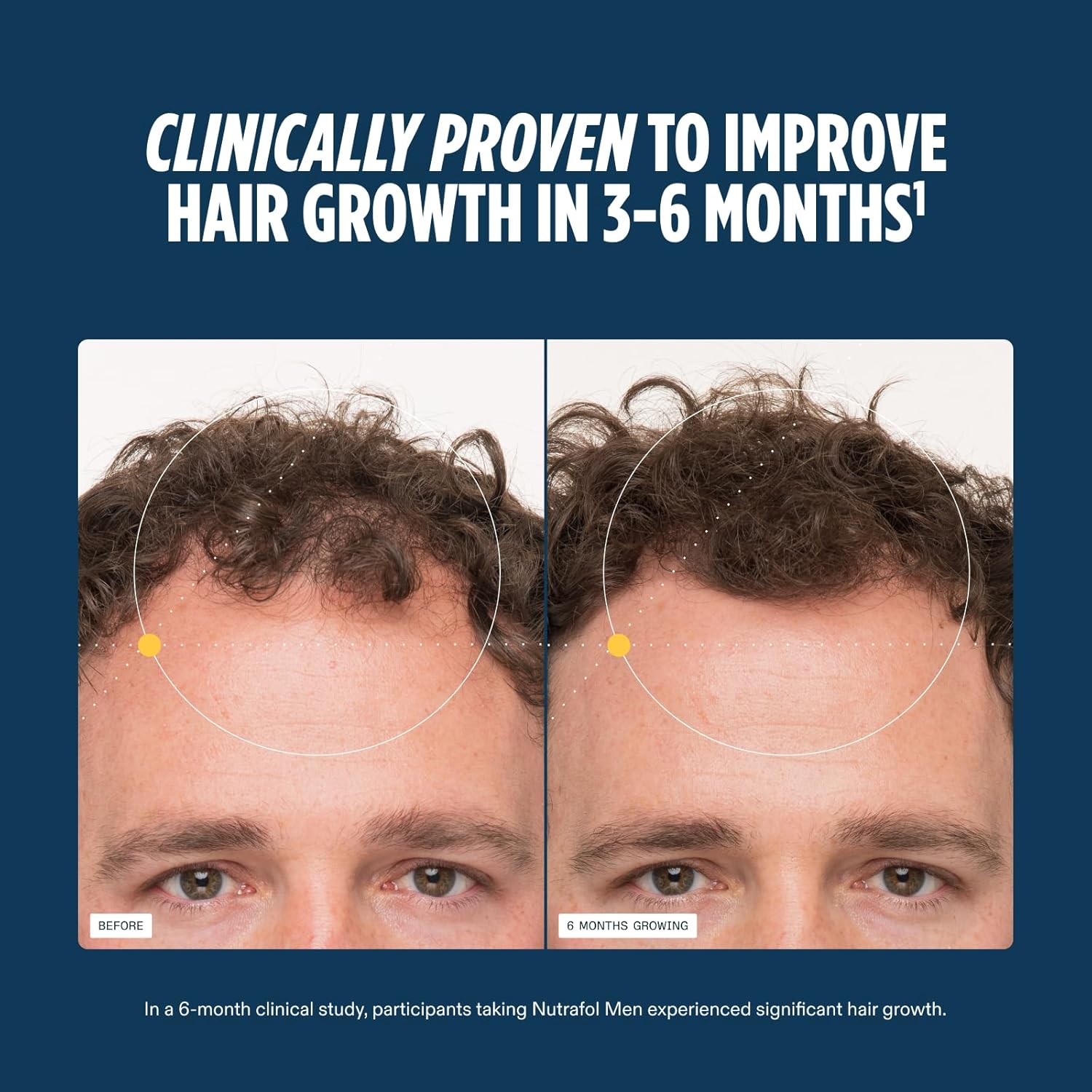 Nutrafol Men's Hair Growth SupTLements, Clinically Tested for Visibly Thicker Hair and Scalp Coverage, Dermatologist Recommended - 1 Month SupTLy, 1 Refill Pouch