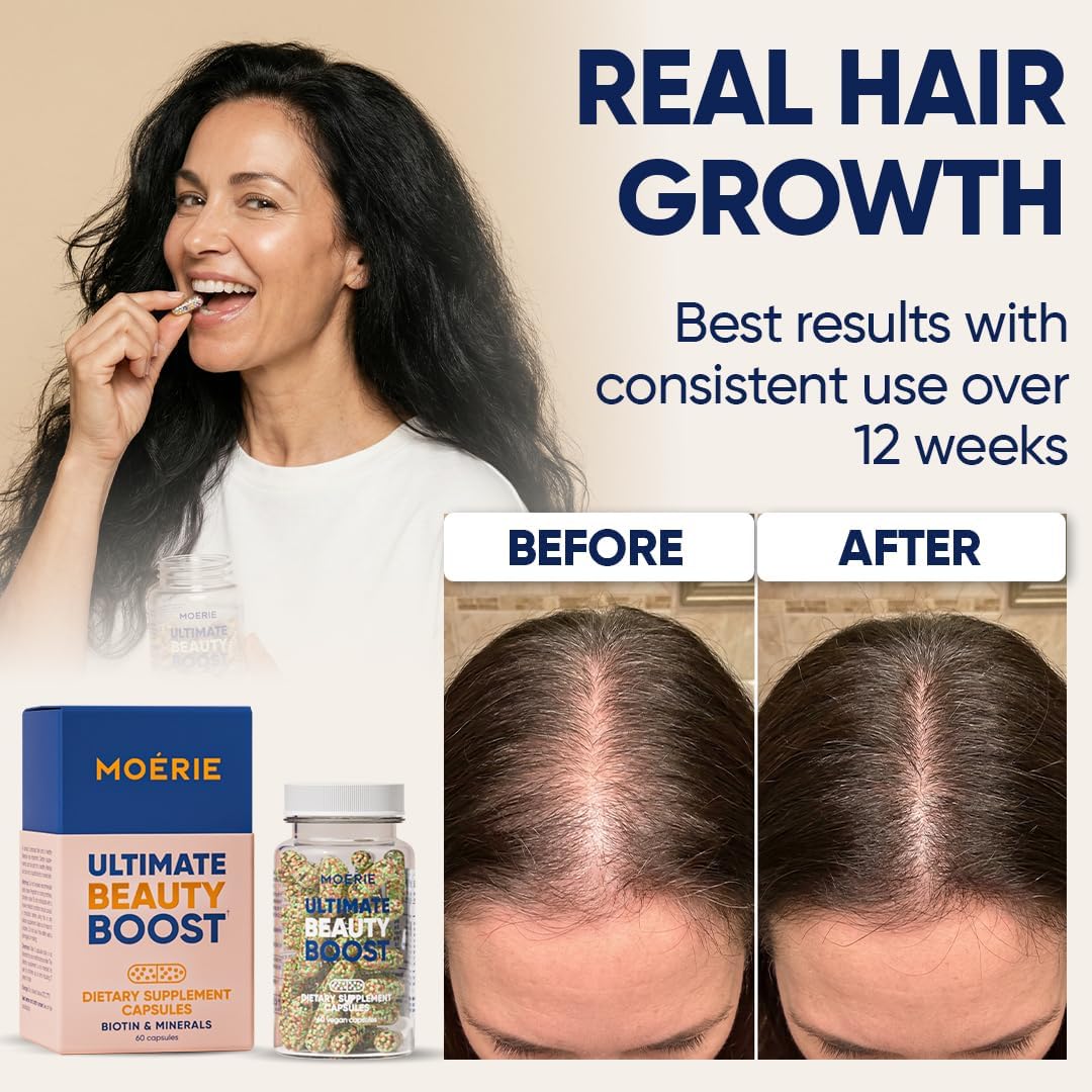 Moerie Ultimate Hair Growth Supplements for Women & Men - Hair, Skin, Nails Vitamins with Biotin & Minerals for Hair Health - Thicker Hair - 60 Capsules