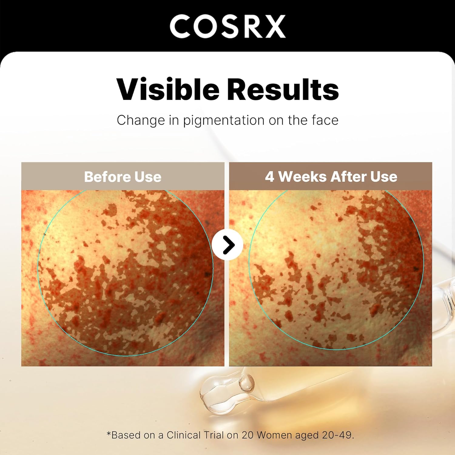 COSRX 2% Alpha Arbutin Discoloration Care Face Serum with Niacinamide, Glutathione & Tranexamic Acid, Dark Spot, Uneven Tone Care, Daily Korean Skin Care for Men and Women, 1.7 fl oz