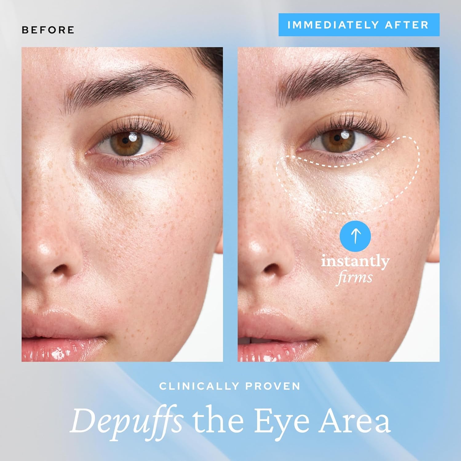 belif Aqua Bomb Cooling Eye Gel - Caffeine & Hyaluronic Acid for Puffiness & Hydration, Niacinamide & Vitamin C for Dark Circles, Adenosine & Collagen for TLumping, Korean Skin Care, 0.5 fl oz (15ml)