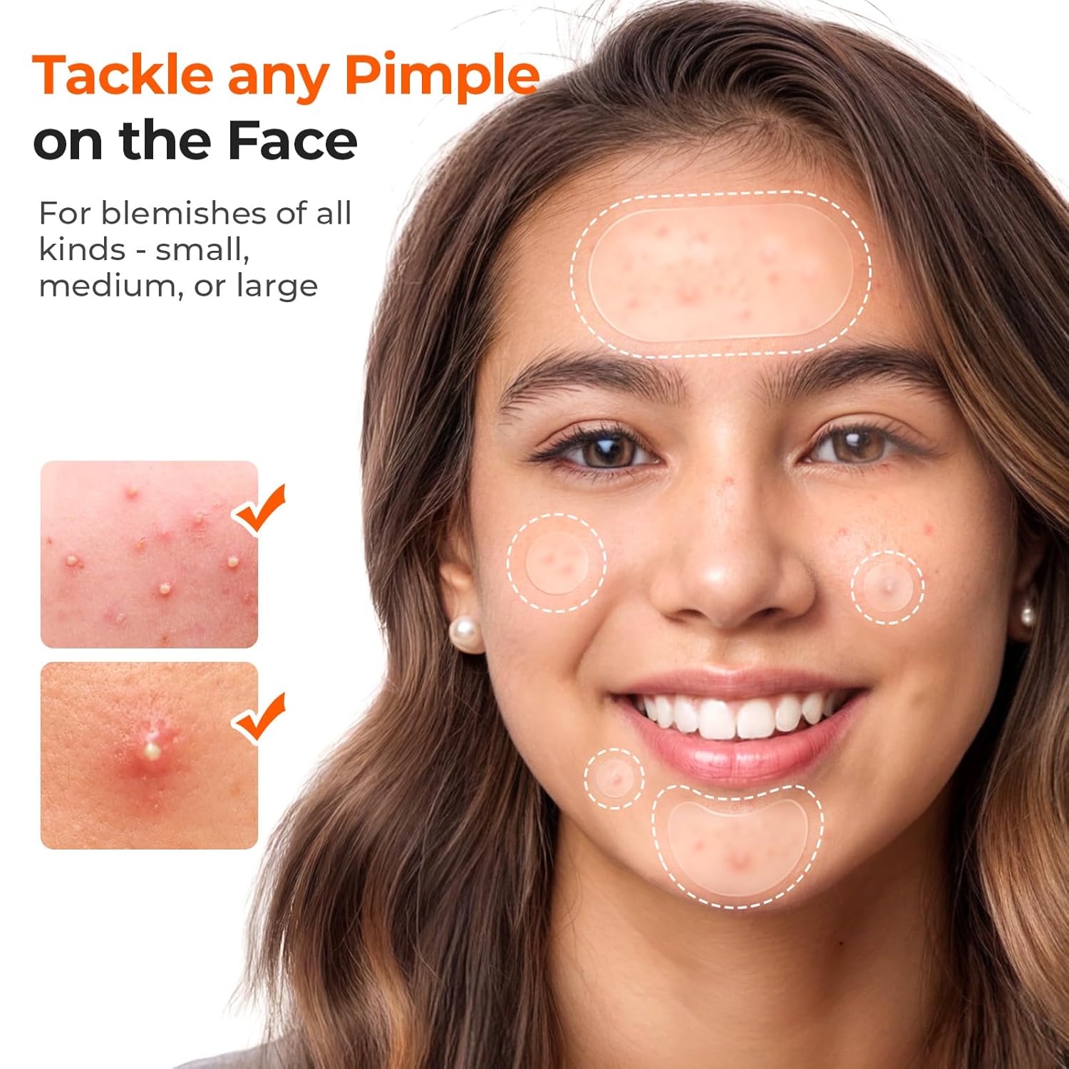 TKTK 443 Count PimTLe Patches for Face, Hydrocolloid Acne Patch Bulk, Acne Stickers for Covering Cheeks, Forehead, Chin Blemishes Zit Breakouts for All Skin Types (Dots, Strip, Contoured 5 Sizes)