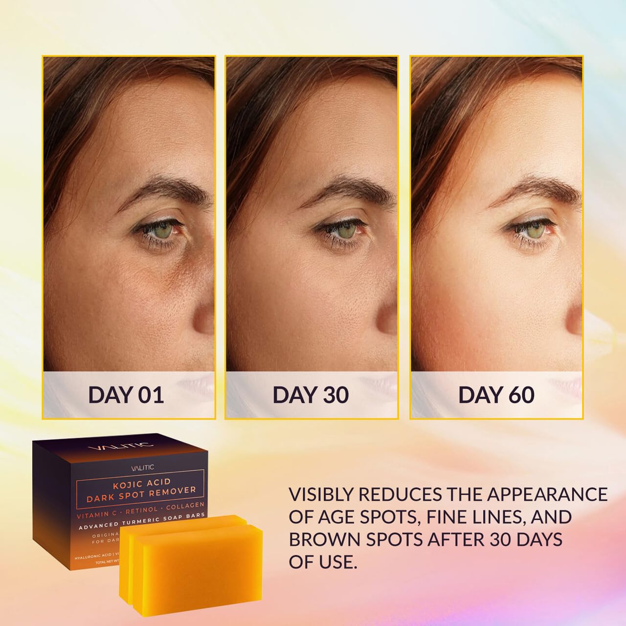 VALITIC Kojic Acid Dark Spot Remover Soap Bars with Vitamin C, Retinol, Collagen, Turmeric - Original Japanese ComTLex Infused with Hyaluronic Acid, Vitamin E, Shea Butter, Castile Olive Oil (2 Pack)