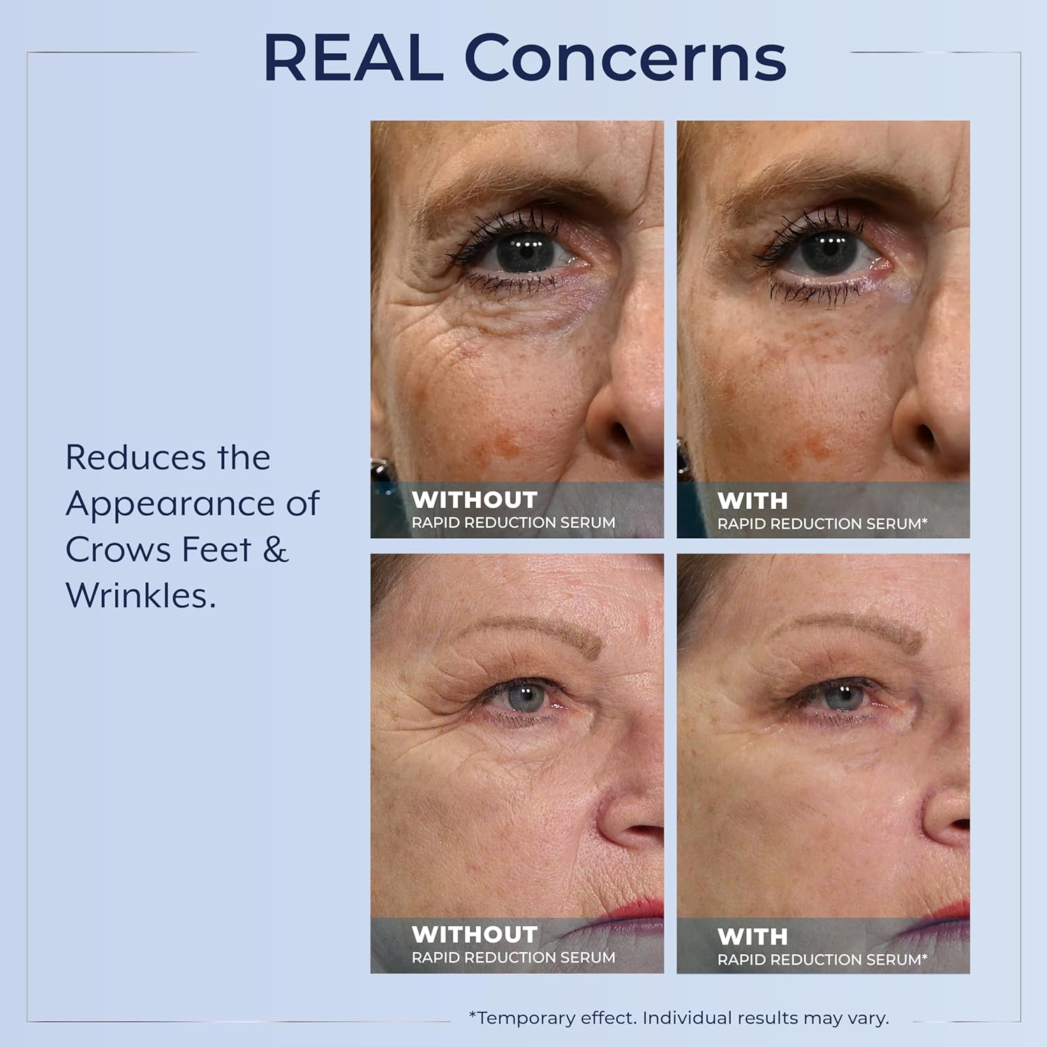 TLexaderm Rapid Reduction Eye Serum - Visibly Reduces Under-Eye Bags, Wrinkles, Dark Circles, Fine Lines & Crow's Feet Instantly, Anti Aging Wrinkle Remover for Face, Full Size Tube