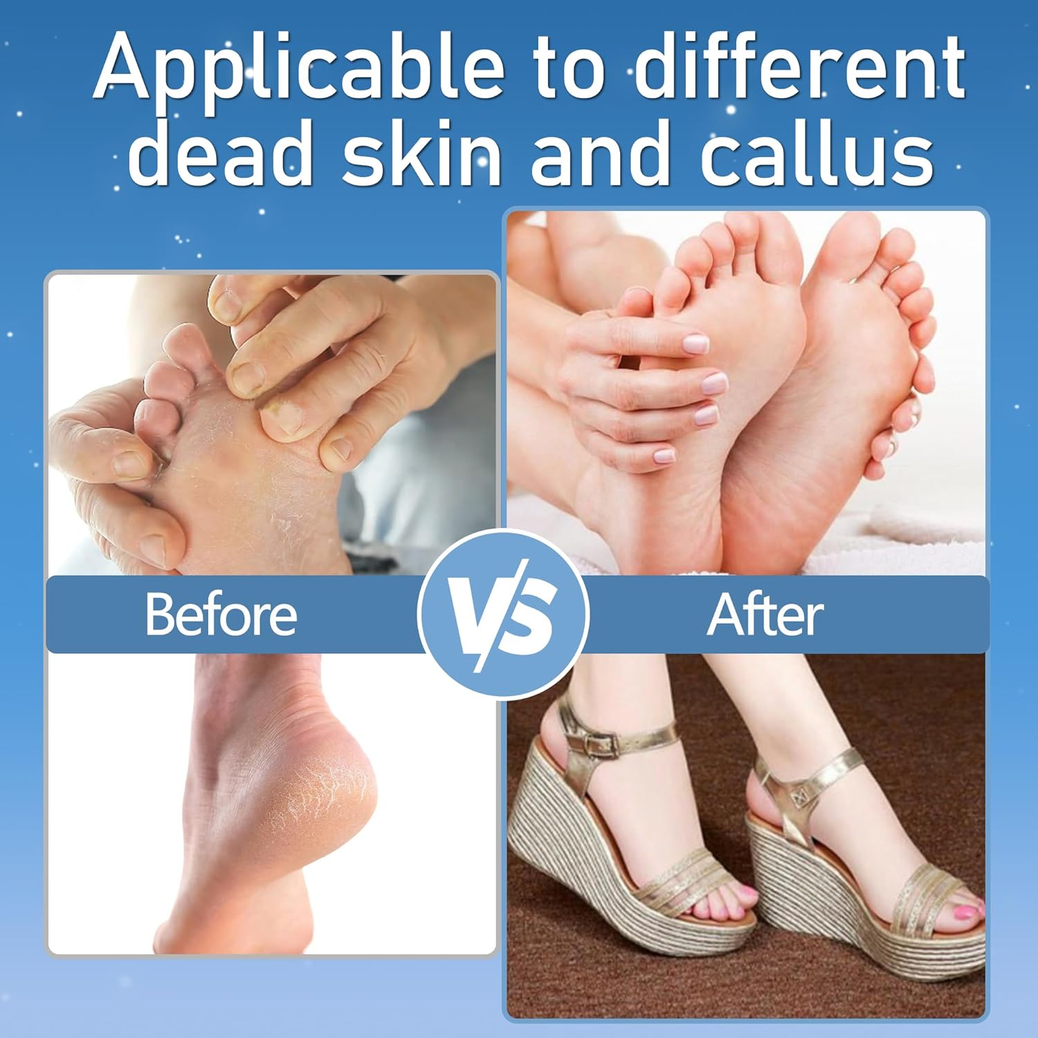 Callus Remover for Feet, Electric Foot Callus Remover Waterproof with 3 Rollers 2 Speed Battery DisTLay,17 in1 Rechargeable Foot File Pedicure Kits for Dead Hard Cracked Dry Skin